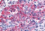 GABBR1 Antibody in Immunohistochemistry (Paraffin) (IHC (P))