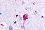 GPR115 Antibody in Immunohistochemistry (Paraffin) (IHC (P))