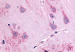 GPR39 Antibody in Immunohistochemistry (Paraffin) (IHC (P))