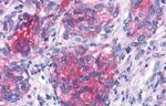 CRTH2 Antibody in Immunohistochemistry (Paraffin) (IHC (P))