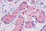 GPR87 Antibody in Immunohistochemistry (Paraffin) (IHC (P))