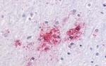 GPR87 Antibody in Immunohistochemistry (Paraffin) (IHC (P))