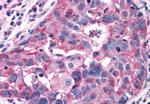 RAI3 Antibody in Immunohistochemistry (Paraffin) (IHC (P))