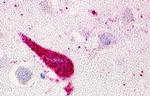 GPRC5D Antibody in Immunohistochemistry (Paraffin) (IHC (P))