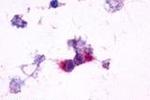 mGluR2 Antibody in Immunocytochemistry (ICC/IF)