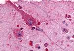 mGluR2 Antibody in Immunohistochemistry (Paraffin) (IHC (P))