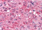 mGluR7 Antibody in Immunohistochemistry (Paraffin) (IHC (P))