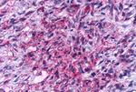 KISS1R Antibody in Immunohistochemistry (Paraffin) (IHC (P))