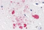 NR1D1 Antibody in Immunohistochemistry (Paraffin) (IHC (P))