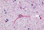 NTSR1 Antibody in Immunohistochemistry (Paraffin) (IHC (P))