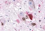 OR10R2 Antibody in Immunohistochemistry (Paraffin) (IHC (P))