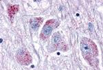 OXGR1 Antibody in Immunohistochemistry (Paraffin) (IHC (P))