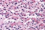 OXGR1 Antibody in Immunohistochemistry (Paraffin) (IHC (P))