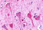 P2Y8 Antibody in Immunohistochemistry (Paraffin) (IHC (P))