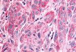 PTPRE Antibody in Immunohistochemistry (Paraffin) (IHC (P))