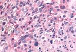 PTPRE Antibody in Immunohistochemistry (Paraffin) (IHC (P))