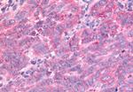 PTPRE Antibody in Immunohistochemistry (Paraffin) (IHC (P))