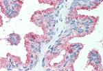 ZIP14 Antibody in Immunohistochemistry (Paraffin) (IHC (P))