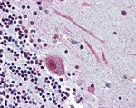 SLC5A9 Antibody in Immunohistochemistry (Paraffin) (IHC (P))