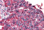 TAS1R3 Antibody in Immunohistochemistry (Paraffin) (IHC (P))