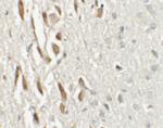 TSHZ3 Antibody in Immunohistochemistry (IHC)