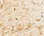 TMEM106A Antibody in Immunohistochemistry (IHC)