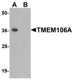 TMEM106A Antibody in Western Blot (WB)