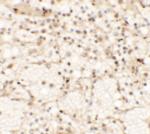 Dectin 1 Antibody in Immunohistochemistry (IHC)