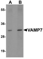 VAMP7 Antibody in Western Blot (WB)