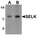 SELK Antibody in Western Blot (WB)