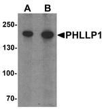 PHLPP1 Antibody in Western Blot (WB)