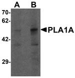 PLA1A Antibody in Western Blot (WB)