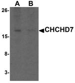 CHCHD7 Antibody in Western Blot (WB)