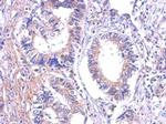 LTB4R Antibody in Immunohistochemistry (Paraffin) (IHC (P))