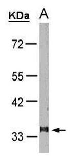 LTB4R Antibody in Western Blot (WB)