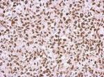 RAD17 Antibody in Immunohistochemistry (Paraffin) (IHC (P))