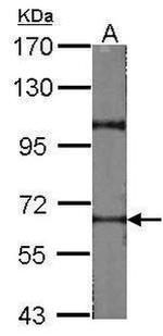 RAD17 Antibody in Western Blot (WB)