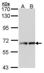 RAD17 Antibody in Western Blot (WB)