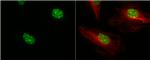 53BP1 Antibody in Immunocytochemistry (ICC/IF)