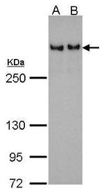 53BP1 Antibody in Western Blot (WB)