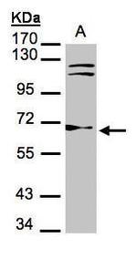 TrxR1 Antibody in Western Blot (WB)