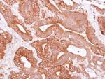 eIF4A1 Antibody in Immunohistochemistry (Paraffin) (IHC (P))