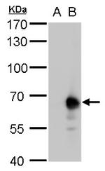 PKLR Antibody in Western Blot (WB)