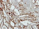 Collagen III Antibody in Immunohistochemistry (Paraffin) (IHC (P))