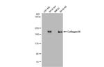 Collagen III Antibody in Western Blot (WB)