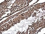 SMAD4 Antibody in Immunohistochemistry (Paraffin) (IHC (P))