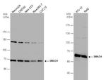 SMAD4 Antibody in Western Blot (WB)