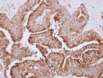 CES2 Antibody in Immunohistochemistry (Paraffin) (IHC (P))