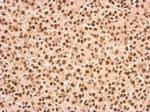 DDX23 Antibody in Immunohistochemistry (Paraffin) (IHC (P))