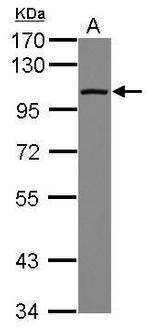 DDX23 Antibody in Western Blot (WB)